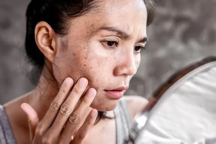 Tips Melindungi Kulit dari Polusi dan Cuaca Ekstrem